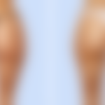 Comment perdre 30 kilos durablement : méthodes éprouvées et conseils pour un succès assuré